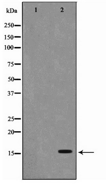 Western blot analysis of extracts of various cell lines, using Acetyl-Histone H2B-K5 antibody (TA377051) at 1:1000 dilution.NIH/3T3 cells were treated by TSA (1 uM) at 37℃ for 18 hours.C6 cells were treated by TSA (1 uM) at 37℃ for 18 hours|Secondary antibody: HRP Goat Anti-Rabbit IgG (H+L) at 1:10000 dilution.|Lysates/proteins: 25ug per lane.|Blocking buffer: 3% BSA.|Detection: ECL Basic Kit .|Exposure time: 60s.