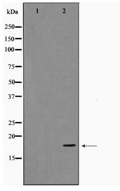 Western blot analysis of extracts of NIH/3T3 cells, using Acetyl-Histone H3-K4 antibody (TA377056) at 1:1000 dilution.NIH/3T3 cells were treated by TSA (1 uM) at 37℃ for 18 hours.|Secondary antibody: HRP Goat Anti-Rabbit IgG (H+L) at 1:10000 dilution.|Lysates/proteins: 25ug per lane.|Blocking buffer: 3% nonfat dry milk in TBST.|Detection: ECL Basic Kit .|Exposure time: 300s.