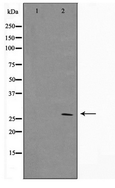 Western blot analysis of extracts of various cell lines, using Acetyl-Histone H3-K9/K14/K18/K23/K27 antibody (TA377059) at 1:1000 dilution.HeLa cells and NIH/3T3 cells and C6 cells were treated by TSA (1 uM) at 37℃ for 18 hours.|Secondary antibody: HRP Goat Anti-Rabbit IgG (H+L) at 1:10000 dilution.|Lysates/proteins: 25ug per lane.|Blocking buffer: 3% nonfat dry milk in TBST.|Detection: ECL Basic Kit .|Exposure time: 10s.