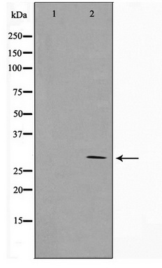 Western blot analysis of extracts of various cell lines, using Acetyl-Histone H3-K23 antibody (TA377060) at 1:500 dilution.HeLa cells and NIH/3T3 cells were treated by TSA (1 uM) at 37℃ for 18 hours.|Secondary antibody: HRP Goat Anti-Rabbit IgG (H+L) at 1:10000 dilution.|Lysates/proteins: 25ug per lane.|Blocking buffer: 3% nonfat dry milk in TBST.|Detection: ECL Basic Kit .|Exposure time: 1s.