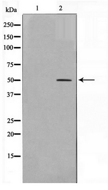 Dot-blot analysis of all sorts of methylation peptides using Acetyl-Histone H3-K18 antibody (TA377067) at 1:1000 dilution.