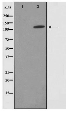 Western blot analysis on HepG2 cell lysate using SUPT16H Antibody
