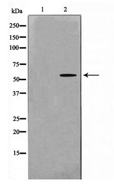 Western blot analysis of extracts of various cell lines, using Acetyl-Histone H4-K5 antibody (TA377080) at 1:1000 dilution. HeLa cells were treated by TSA (1uM) for 18 hours. C6 cells were treated by TSA (1uM) for 18 hours.|Secondary antibody: HRP Goat Anti-Rabbit IgG (H+L) at 1:10000 dilution.|Lysates/proteins: 25ug per lane.|Blocking buffer: 3% nonfat dry milk in TBST.|Detection: ECL Basic Kit .|Exposure time: 30s.