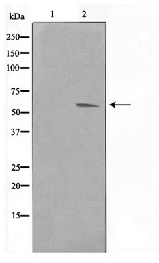 Western blot analysis of extracts of various cell lines, using Acetyl-Histone H4-K5 antibody (TA377085) at 1:1000 dilution.HeLa cells,NIH/3T3 cells and C6 cells were treated by TSA (1 uM) at 37℃ for 18 hours.|Secondary antibody: HRP Goat Anti-Rabbit IgG (H+L) at 1:10000 dilution.|Lysates/proteins: 25ug per lane.|Blocking buffer: 3% nonfat dry milk in TBST.|Detection: ECL Basic Kit .|Exposure time: 60s.