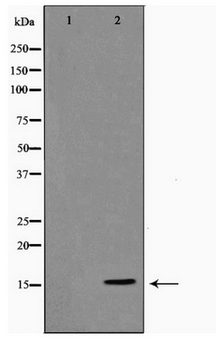 Western blot analysis of extracts of various cell lines, using Acetyl-Histone H4-K8 antibody (TA377088) at 1:1000 dilution.NIH/3T3 cells and C6 cells were treated by TSA (1 uM) at 37℃ for 18 hours.|Secondary antibody: HRP Goat Anti-Rabbit IgG (H+L) at 1:10000 dilution.|Lysates/proteins: 25ug per lane.|Blocking buffer: 3% nonfat dry milk in TBST.|Detection: ECL Basic Kit .|Exposure time: 30s.