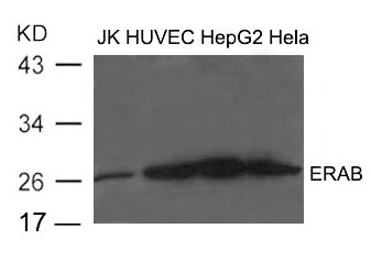 Western blot analysis of extract from JK, HUVEC, HepG2 and Hela cells using ERAB Antibody