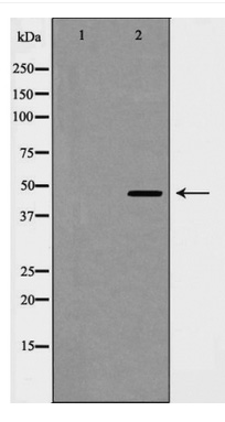 Western blot analysis of Cyclin E2 expression in COLO cells