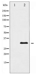 Western blot analysis of extracts of various cell lines, using IK antibody (TA377402) at 1:1000 dilution.|Secondary antibody: HRP Goat Anti-Rabbit IgG (H+L) at 1:10000 dilution.|Lysates/proteins: 25ug per lane.|Blocking buffer: 3% nonfat dry milk in TBST.|Detection: ECL Enhanced Kit .|Exposure time: 15S.