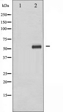 Western blot analysis of p56 Dok-2 phosphorylation expression in K562 whole cell lysates, The lane on the left is treated with the antigen-specific peptide.