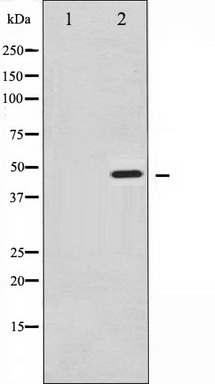 Host: Rabbit Target Name: SERAC1 Sample Tissue: Human Thymus Tumor lysates Antibody Dilution: 1ug/ml