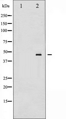 Western blot analysis of SEK1/MKK4 phosphorylation expression in UV treated 293 whole cell lysates, The lane on the left is treated with the antigen-specific peptide.