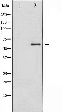 WB Suggested Anti-Adcyap1r1 Antibody Titration: 1.0ug/ml Positive Control: Rat Brain