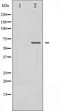Western blot analysis of MAP3K7 expression in Jurkat whole cell lysates, The lane on the left is treated with the antigen-specific peptide.