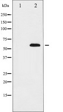 Western blot analysis of p56 Dok-2 expression in K562 whole cell lysates, The lane on the left is treated with the antigen-specific peptide.
