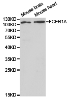 Western blot analysis of extracts of mouse spleen cell lines, using FCER1A antibody.