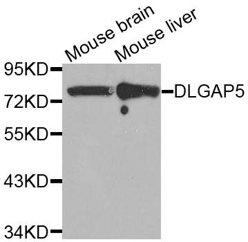 Western blot analysis of extracts of various tissues, using DLGAP5 antibody.