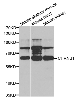 Western blot analysis of extracts of various cell lines, using CHRNB1 antibody.