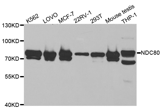 Western blot analysis of extracts of various cell lines, using NDC80 antibody.