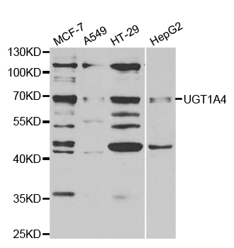 Western blot analysis of extracts of various cell lines, using UGT1A4 antibody.