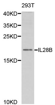 Western blot analysis of extracts of 293T cell lines, using IL28B antibody.