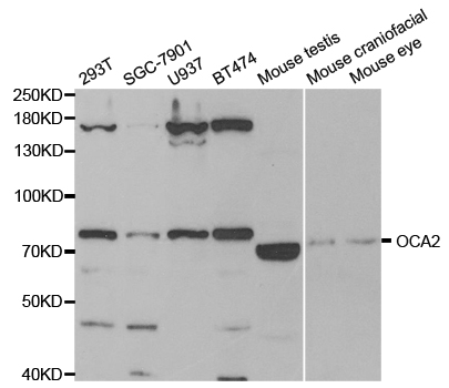 Western blot analysis of extracts of various cell lines, using OCA2 antibody.