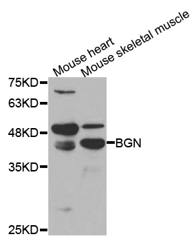 Host: Rabbit Target Name: SEPT6 Sample Tissue: Human Jurkat Whole Cell lysates Antibody Dilution: 1ug/ml