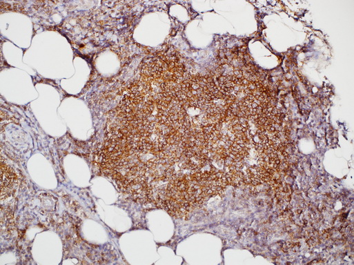 Immunohistochemistry staining of Paraffin Tonsil, lymph node tissue by HGAL antibody (dilution: 1:100 - 1:500; visualization of staining: Cytoplasmic)