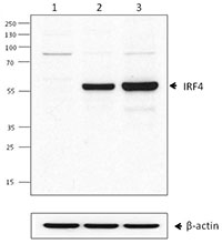 Western blot analysis of Daudi (lane 1), Raji (lane 2) and A20 (lane 3) cells using IRF4 antibody (clone IRF4.3E4). beta-actin antibody (poly6221) was used as loading control.