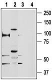 Western blot analysis of rat kidney (lanes 1 and 3) and PC3 cell line (lanes 2 and 4) lysates: 1, 2. Anti-TRPV5 antibody, (1:200). 3, 4. Anti-TRPV5 antibody, preincubated with the control peptide antigen.