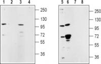 Western blot analysis of rat lung membrane (lanes 1 and 2), rat testes (lanes 3 and 4), mouse ms1 cells (lanes 5 and 7) and human LNCaP cell (lanes 6 and 8) lysates: 1, 3, 5, 6. Anti-TRPM5 antibody, (1:200). 2, 4, 7, 8. Anti-TRPM5 antibody, preincubated with the control peptide antigen.