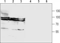 Western blot analysis of rat brain (lanes 1 and 4), mouse brain (lanes 2 and 5) and human U87-MG glioma cell (lanes 3 and 6) lysates: 1-3. Anti-Glycine Transporter 1 (GlyT1) (extracellular) antibody, (1:200). 4-6. Anti-Glycine Transporter 1 (GlyT1) (extracellular) antibody, preincubated with the control peptide antigen.