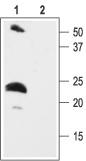 Western blot analysis of rat heart membranes: 1. Anti-KCNE2 (MiRP1) antibody, (1:200). 2. Anti-KCNE2 (MiRP1) antibody, preincubated with the control peptide antigen.