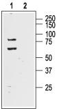 Western blot analysis of rat brain lysate: 1. Anti-KV4.1 antibody, (1:400). 2. Anti-KV4.1 antibody, preincubated with the control peptide antigen.