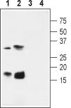 Western blot analysis of rat pancreas membranes (lanes 1 and 3) and rat heart lysate (lanes 2 and 4): 1-2. Anti-KCNE4 (MiRP3) antibody, (1:600). 3-4. Anti-KCNE4 (MiRP3) antibody, preincubated with the control peptide antigen.