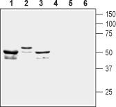 Western blot analysis of mouse brain lysate (lanes 1 and 4), human SHSY-5Y neuroblastoma cell line lysate (lanes 2 and 5) and rat brain membranes (lanes 3 and 6): 1-3. Anti-KV5.1 antibody, (1:400). 4-6. Anti-KV5.1 antibody, preincubated with the control peptide antigen.