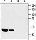Western blot analysis of rat (lanes 1 and 3) and mouse (lanes 2 and 4) heart lysates: 1-2. Anti-KV1.8 antibody, (1:800). 3-4. Anti-KV1.8 antibody, preincubated with the control peptide antigen.