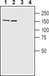 Western blot analysis of rat (lanes 1 and 3) and mouse (lanes 2 and 4) brain lysates: 1-2. Anti-Caspr2 antibody, (1:200). 3-4. Anti-Caspr2 antibody, preincubated with the control peptide antigen.