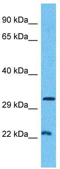Host: Rabbit Target Name: ALPL Sample Tissue: Human Jurkat Whole Cell Antibody Dilution: 1.0ug/ml