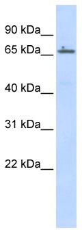 WB Suggested Anti-ZNF503 Antibody Titration: 0.2-1 ug/ml; ELISA Titer: 1:312500; Positive Control: Human Placenta