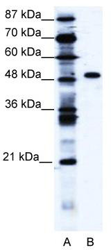 WB Suggested Anti-ZNF541 Antibody Titration: 1.25ug/ml; ELISA Titer: 1:1562500; Positive Control: Jurkat cell lysate