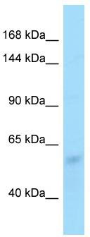 Host: Rabbit; Target Name: Zfp708; Sample Tissue: Mouse Lung lysates; Antibody Dilution: 1.0ug/ml