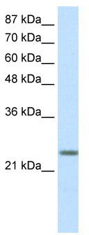 WB Suggested Anti-MXD3 Antibody Titration: 0.5ug/ml; ELISA Titer: 1:312500; Positive Control: Transfected 293T