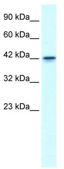 WB Suggested Anti-GFI1B Antibody Titration: 0.2-1 ug/ml; ELISA Titer: 1:312500; Positive Control: Jurkat cell lysate
