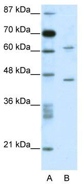 WB Suggested Anti-C1ORF25 Antibody Titration: 0.2-1 ug/ml; ELISA Titer: 1:312500; Positive Control: Jurkat cell lysate