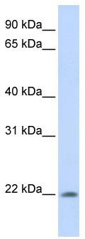 WB Suggested Anti-C2orf28 Antibody Titration: 0.2-1 ug/ml; ELISA Titer: 1:62500; Positive Control: Human Muscle