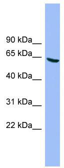 WB Suggested Anti-DYRK3 Antibody Titration: 0.2-1 ug/ml; ELISA Titer: 1:312500; Positive Control: HT1080 cell lysateDYRK3 is supported by BioGPS gene expression data to be expressed in HT1080