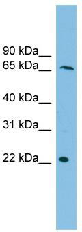 WB Suggested Anti-DYRK3 Antibody Titration: 0.2-1 ug/ml; ELISA Titer: 1:312500; Positive Control: THP-1 cell lysate