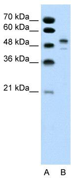 WB Suggested Anti-POU3F2 Antibody Titration: 0.5ug/ml; ELISA Titer: 1:12500; Positive Control: Jurkat cell lysate