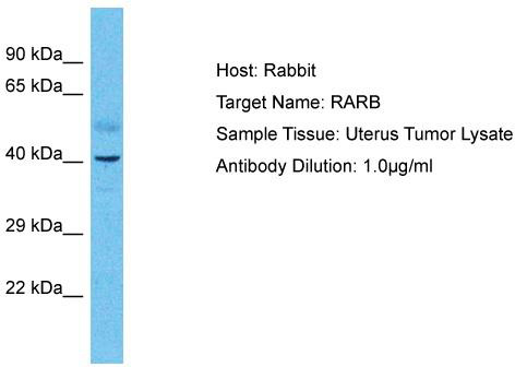 Host: Rabbit; Target Name: RARB; Sample Tissue: Uterus Tumor lysates; Antibody Dilution: 1.0ug/ml