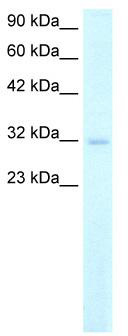 WB Suggested Anti-MSX1 Antibody Titration: 2.0ug/ml; ELISA Titer: 1:62500; Positive Control: Human Kidney